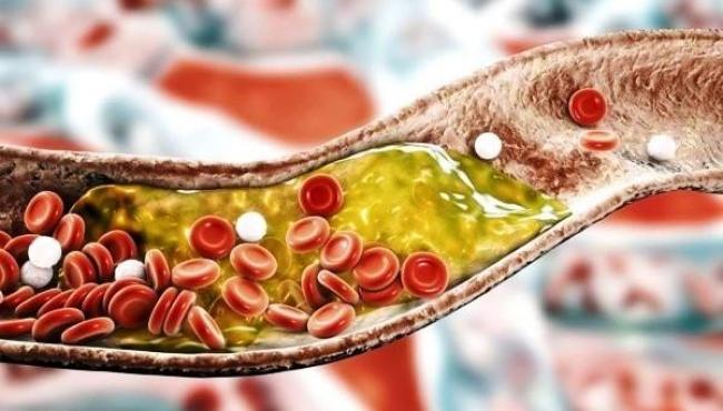 Médicas listam dicas para melhorar a saúde e reduzir o colesterol ruim