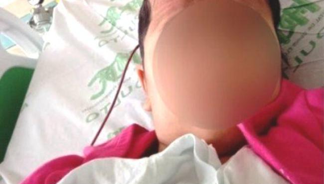 Menina de 9 anos fica 21 dias internada e quase cega após escova progressiva