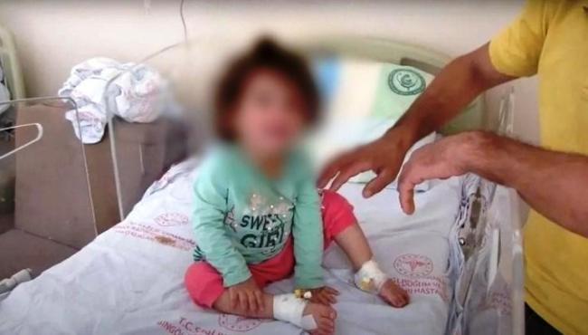 Menina de dois anos mata cobra com mordidas após levar picada no lábio