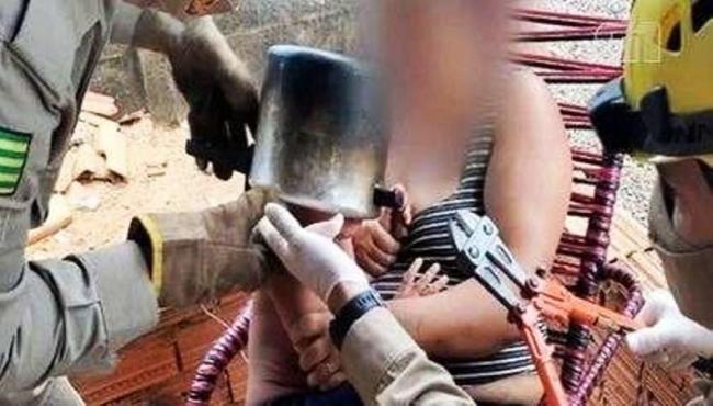 Menino de 2 anos fica com a cabeça presa em panela de pressão