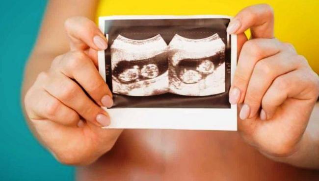 Mulher com dois úteros carrega gêmeos gestados separadamente