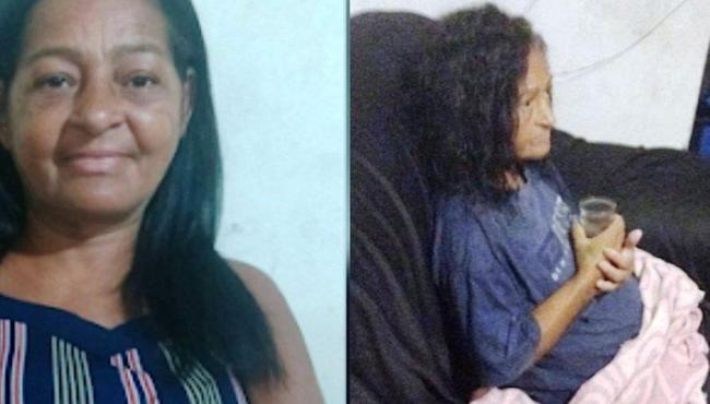 Mulher é enterrada viva na Bahia, escapa, mas fica com sequelas