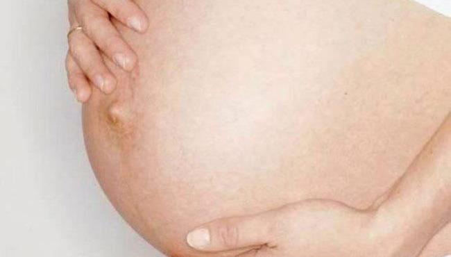 Mulher grávida tem pedido de cesárea negado e carrega bebe morto na barriga por 7 dias