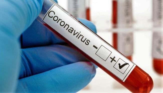 Nas últimas 24 horas, ES registra 36 novos casos de Covid-19 e nenhuma morte