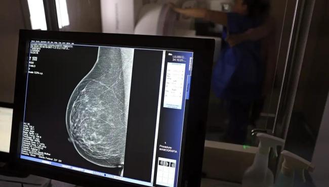 Nova lei reforça direito a três folgas por ano para exames preventivos