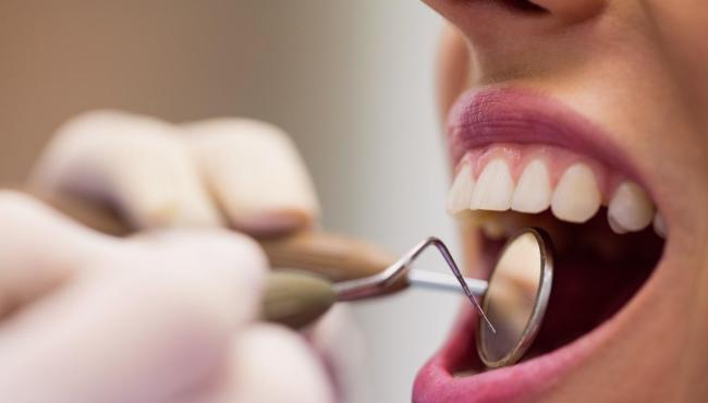 O que fazer quando o dente fica alto após a restauração?