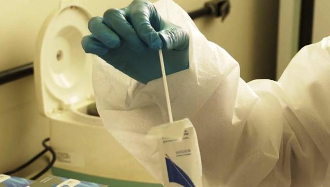 Pontos de testagem de Covid-19 em massa serão mantidos até o fim de março no ES