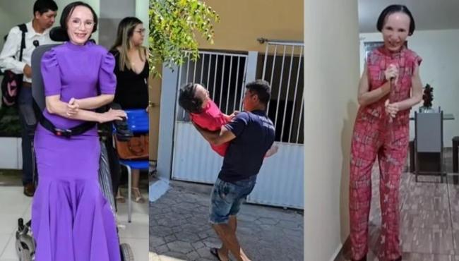 “Prisão feita de ossos”: mulher praticamente não se move há 3 décadas