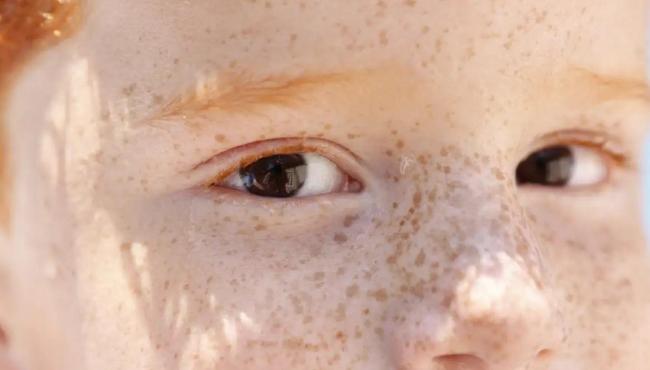 Reflexo branco nos olhos: entenda condição que assusta pais