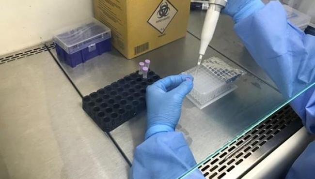 Sesa descarta Covid-19 como causa de surto no Hospital Santa Rita