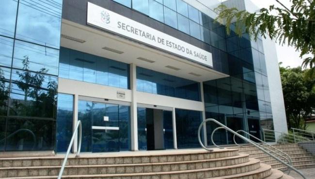 Sesa irá homologar laboratórios particulares para realizar diagnósticos da Covid-19