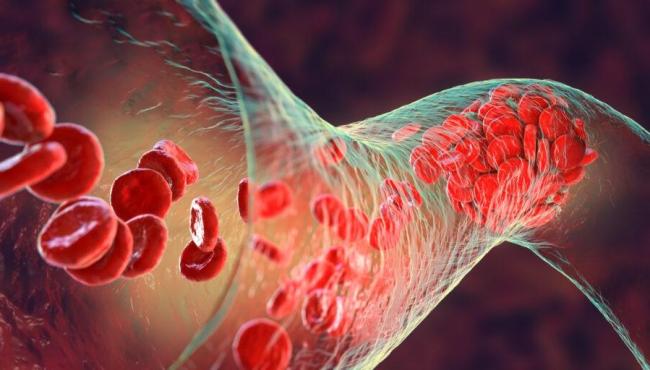 Sinais de deficiência de vitamina K, frequentemente esquecida