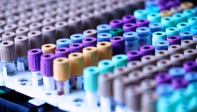 Surto de hepatite em crianças: número de mortes chega a 16