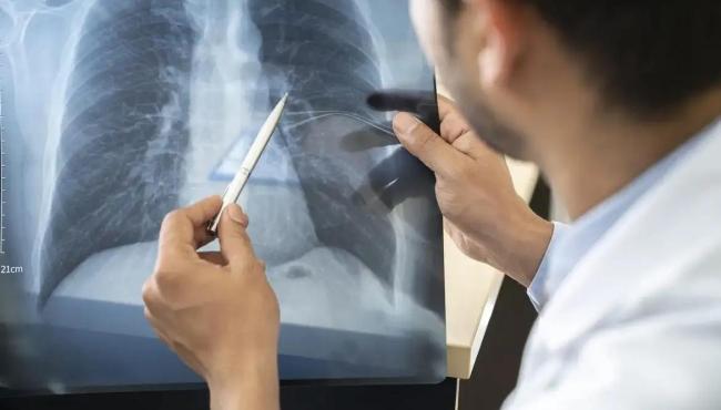 Tabagismo é maior entre jovens de 16 a 24 anos, alerta pesquisa