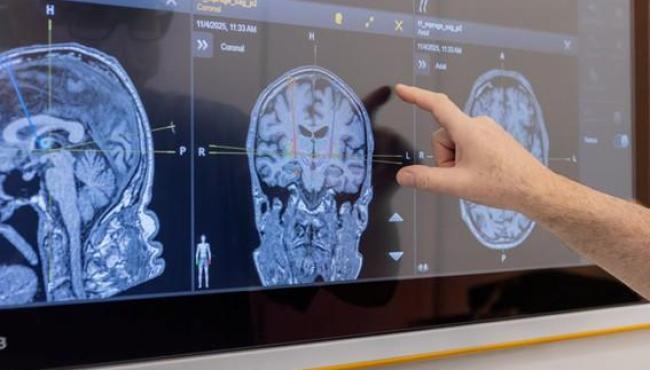 Telemedicina resolve 98% dos casos na atenção primária e reduz espera por especialistas no Rio Grande do Norte