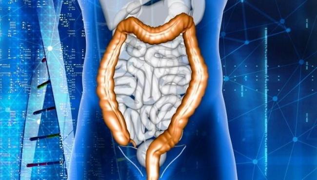 Transplante de cocô pode ser a solução para infecções recorrentes por superbactéria