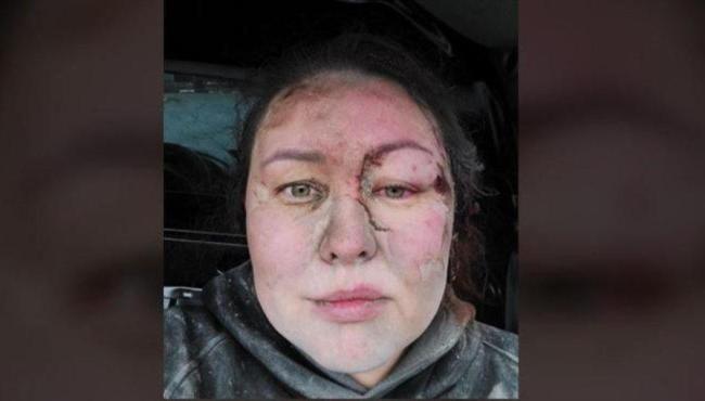Treinadora ucraniana é "enterrada viva" e choca em meio à guerra