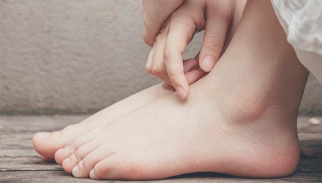 Veja como prevenir a retenção de líquidos e seus sintomas