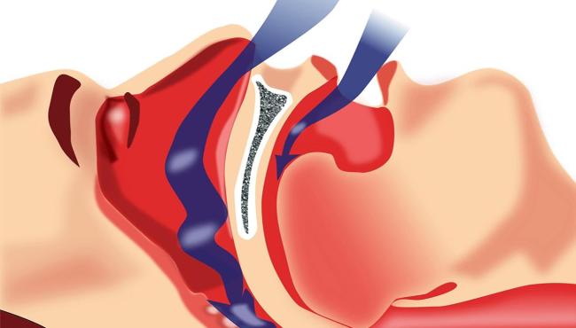 Você acorda com a boca seca e amarga?: Saiba o que é e como resolver